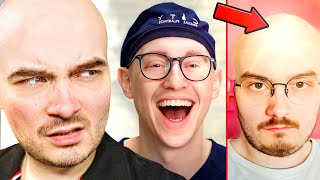 A PLASTIC SURGEON REACTED TO ME GOING BALD...