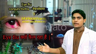 Eye flu kyo fail rha h |Eye flu kaise thik kare |conjunctivitis