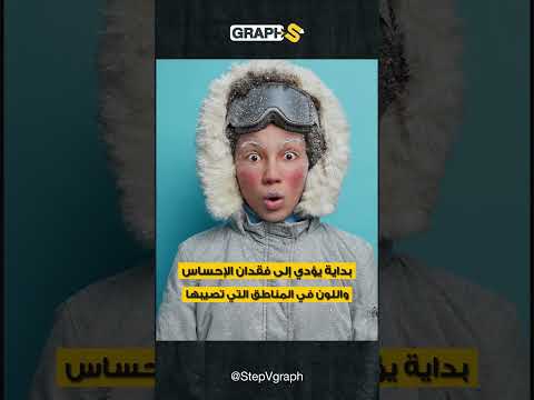 قضمة الصقيع احذر شتاء 2023 حتى لا يأكل أحد أطرافك