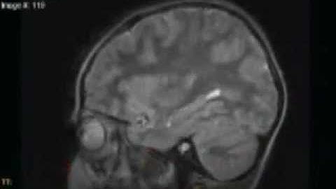 Die-6- ¨Back.te.riality¨