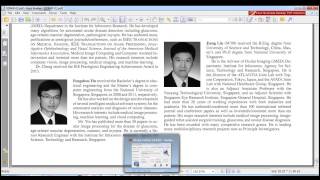 Sparse Dissimilarity-Constrained Coding for Glaucoma Screening|matlab projects in bangalore