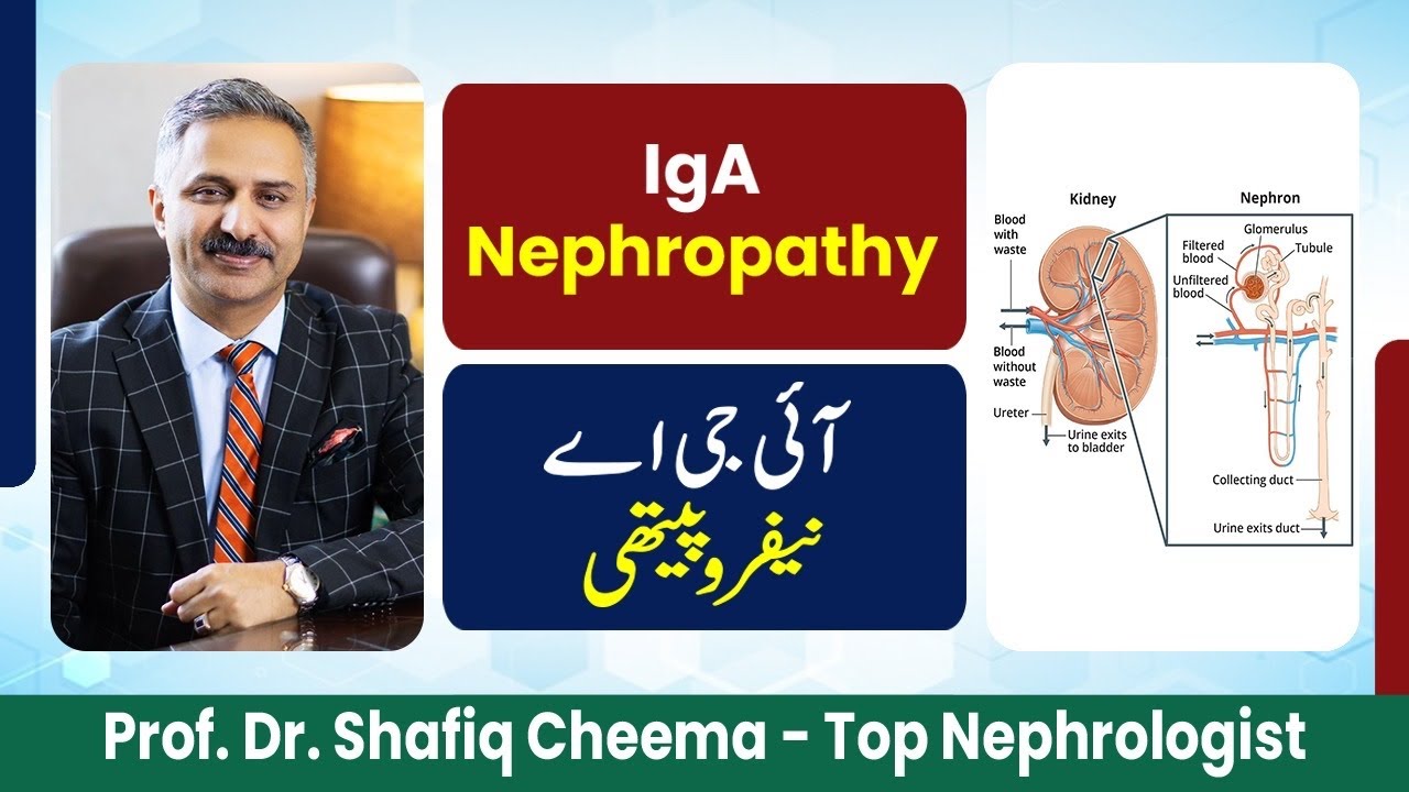 IgA Nephropathy #proteinuria #hematuria #edema #glomerulonephritis #nephchat #imchospital