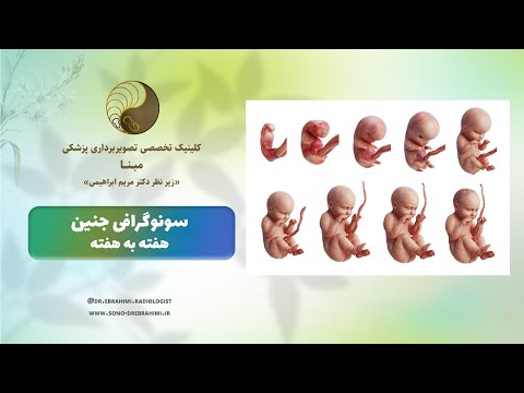 تصاویر واقعی سونوگرافی هفته به هفته جنین سونوگرافی کامل