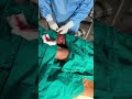 Injury around popliteal fossa #injury ,#leg,#popliteal, #ytshorts