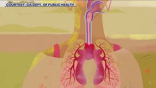 Medical experts warn of rising threat of valley fever