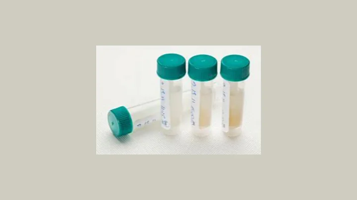 Female Hormone Imbalance Case Histories As Explain...
