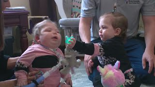 Conjoined Twins Separated At Children's Minnesota Now Happy And Healthy At Home
