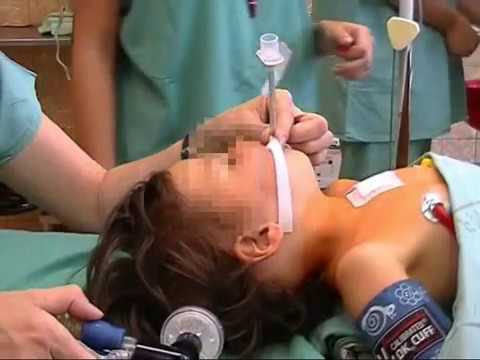 Video: Jaký lékař provádí intubaci?