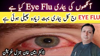 Ankho Ka Flu Kaise Thik Kare | How To Cure Eye Flu | Urdu And Hindhi |