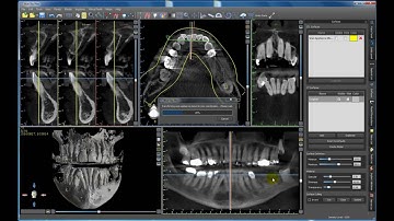 BlueSkyBio Scan Appliance Merge and Digital Pour (Model Reversal)