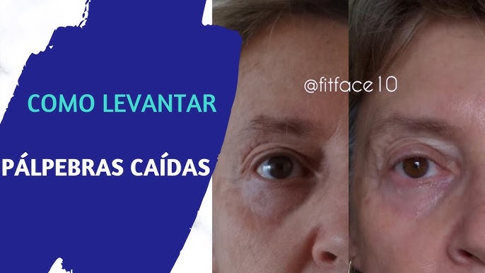 Conheça o mewing, exercício facial que promete reduzir a papada e