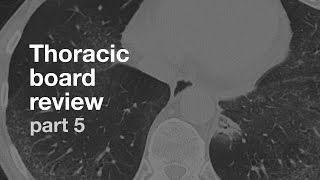 Board Review | Thoracic Radiology | Part 5