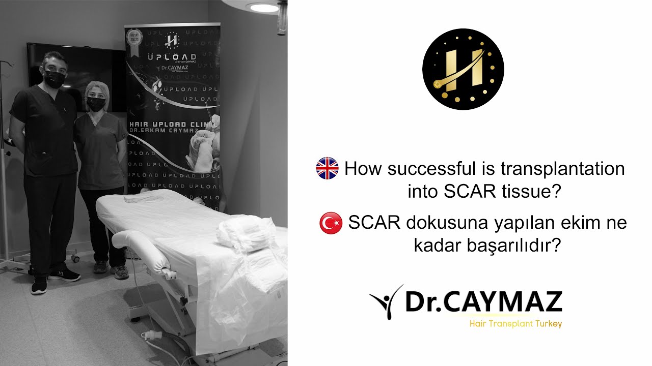 How to succesfull is transplantation into Scar tissue
