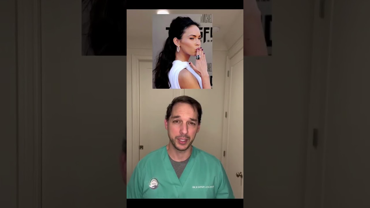 Hand surgeon discusses toe thumbs #MilesTeller #MeganFox #Toethumb #Brachydactyly #Doctor #Thumb