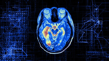 Artificial Intelligence and Imaging - Dr. Lawrence Tanenbaum