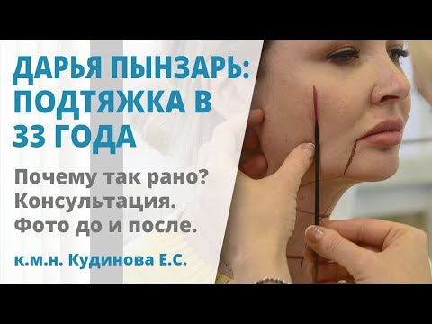 Липосакция и подтяжка лица в 33 года: пластическая операция Дарьи пынзарь