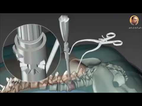 دكتور اشرف اسماعيل  دكتوراه جراحة العظام والإصابات والعمود الفقري