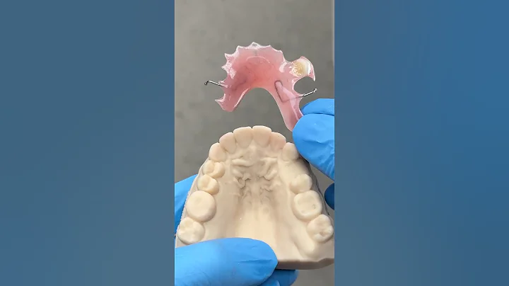 AcryGrip Flipper Partial ​⁠@EnvisiontecMain #envisiontec #lsk121shorts #dentistteeth #dentistry