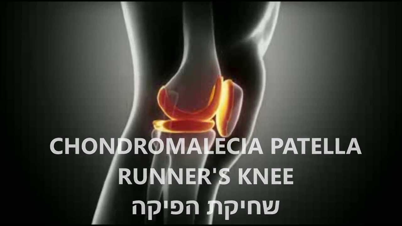 כאבי ברכיים - שחיקת הפיקה בריצה RUNNER's KNEE ד