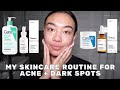 SKINCARE ROUTINE FOR ACNE + DARK SPOTS *NOT UP TO DATE ANYMORE* | SAMANTHAEVIRA