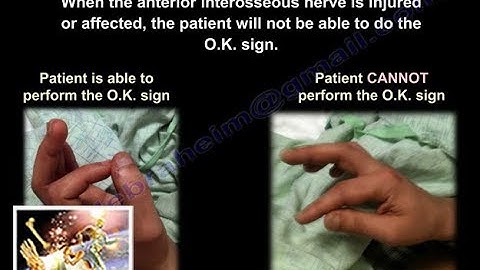 Anterior Interosseous Nerve - Everything You Need To Know - Dr. Nabil Ebraheim