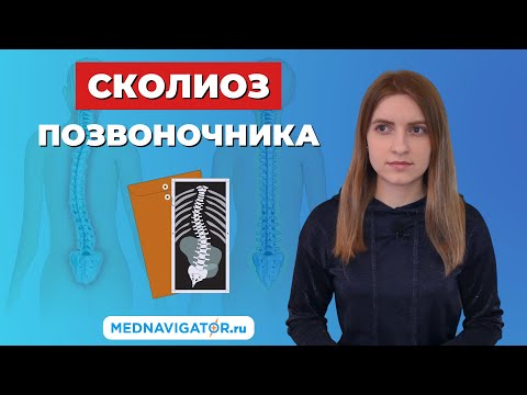 СКОЛИОЗ позвоночника 1, 2, 3 и 4 степени у детей и взрослых - симптомы, причины | Mednavigator.ru