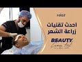 hair transplant turkey Without Pain  افضل مراكز زراعة الشعر في تركيا