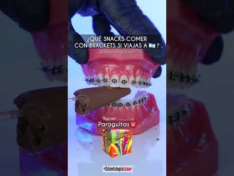 Video: ¿Puedes comer twizzlers con frenillos?
