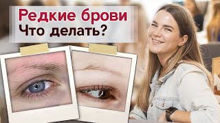 Перещипанные и редкие брови Что делать? | Как происходит перещипывание бровей?