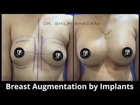 Breast Surgeries, Breast Reduction, Breast Augmentation