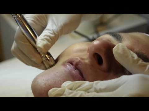 Conoce la Microdermoabrasión o Facial de Punta Diamante