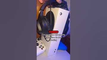 What Happened To Xbox Kinect?🤯
