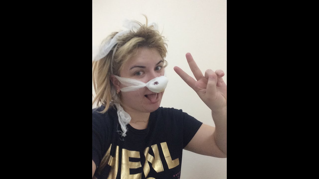 Мой рассказ о том как я пережила операцию на нос ( искривление носовой перегородки и вазотомия)