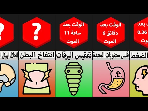 مقارنة جسم الإنسان بعد الموت