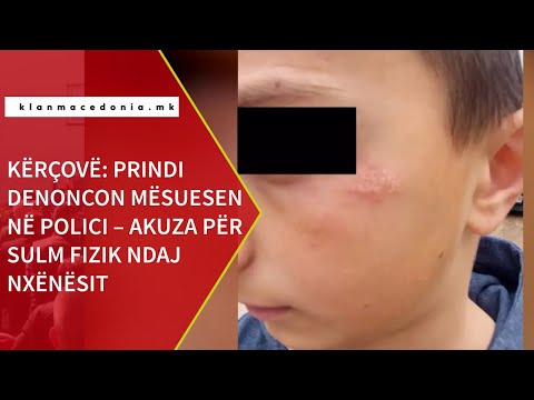 Video: Në paraqitjen e bazuar fizikisht?