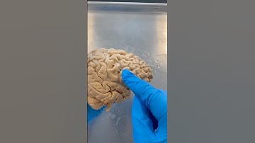 Controlling Your Impulses: Prefrontal Cortex!