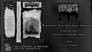 LxIxGxGxVxWxOx - Autopsy Of A Void Born Cadaver (Voidgore - 2025)