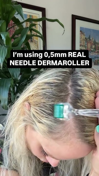 HOW TO STOP HAIR LOSS AFTER PREGNANCY YouTube how-to-stop-hair-loss-after-pregnancy-youtube