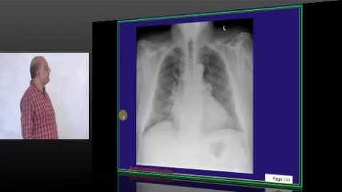 NEETPG Image based MCQ Mock Test Discussion 1648 Lec 01 Download uMedico App