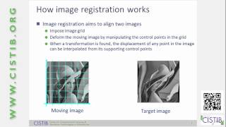 Lung Image Registration