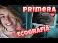 PRIMERA ECOGRAFÍA DEL BEBÉ 🍼 13 semanas de EMBARAZO | Miri Lazaro Vlog