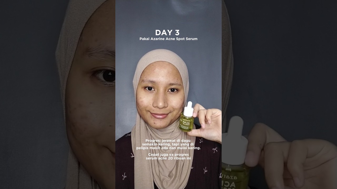 day 3 udah semakin kelihatan progres dari serum 20 ribuan ini, worth to try sih. 
