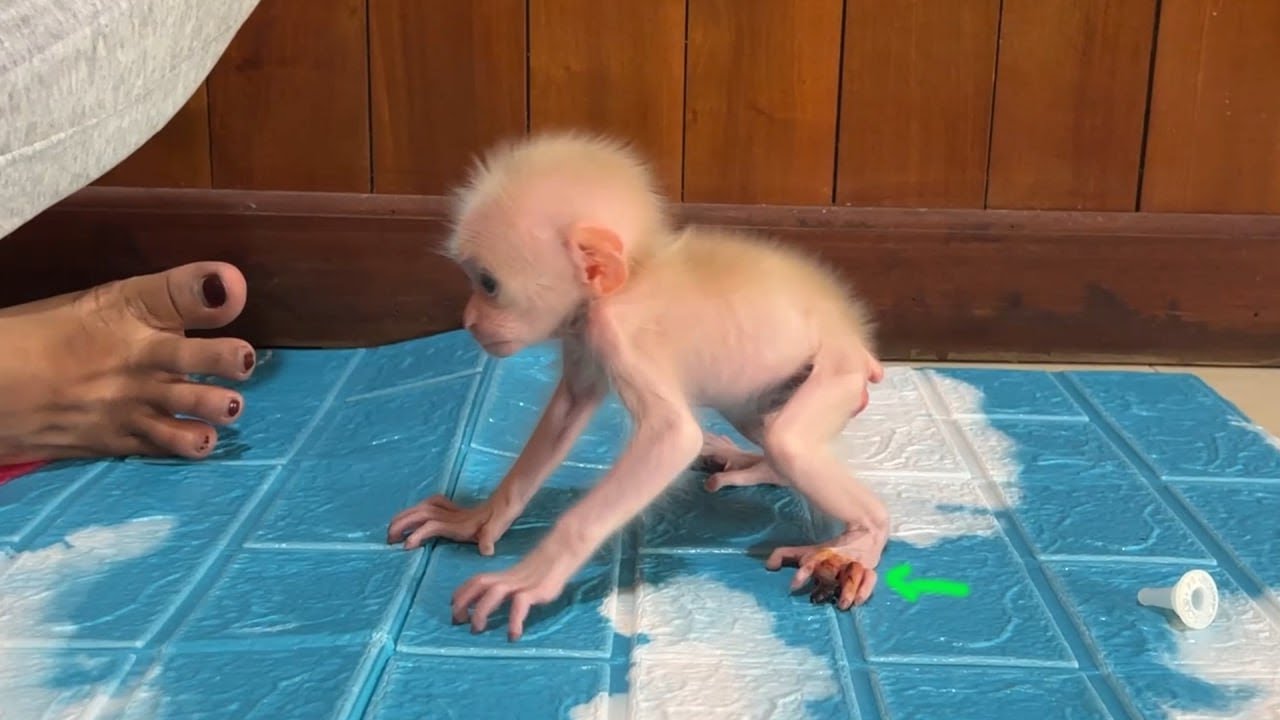 [Fighting]Minea Starting To Walking Step By Step With Her Injured Toe