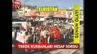 Şehi̇t Ve Protez Bacak