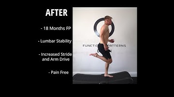 Low Back Pain Running Progress