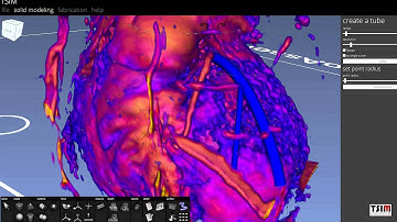 Printing the Heart – TSIM & BioAssemblyBot Workflow