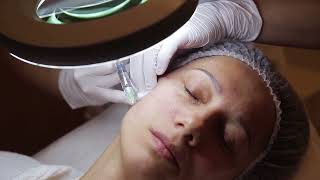 Meso-Wharton P199™ is an injectable preparation for intensive facial rejuvenation.