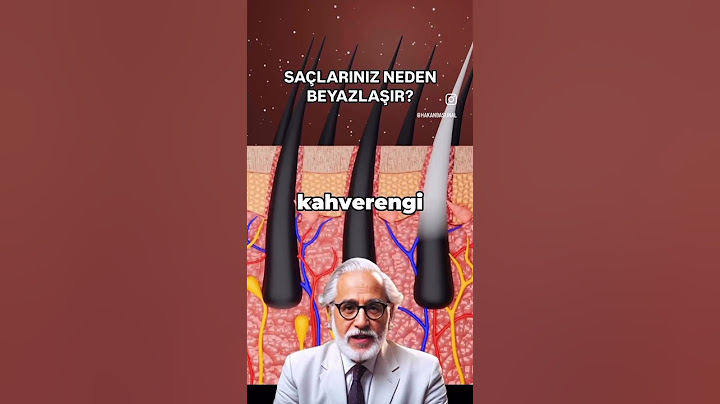Saçlarınız neden beyazlar?