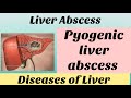 Liver abscess pyogenic abscess with notes bamsfinalyear shalyatantra surgery bams4thyear bams