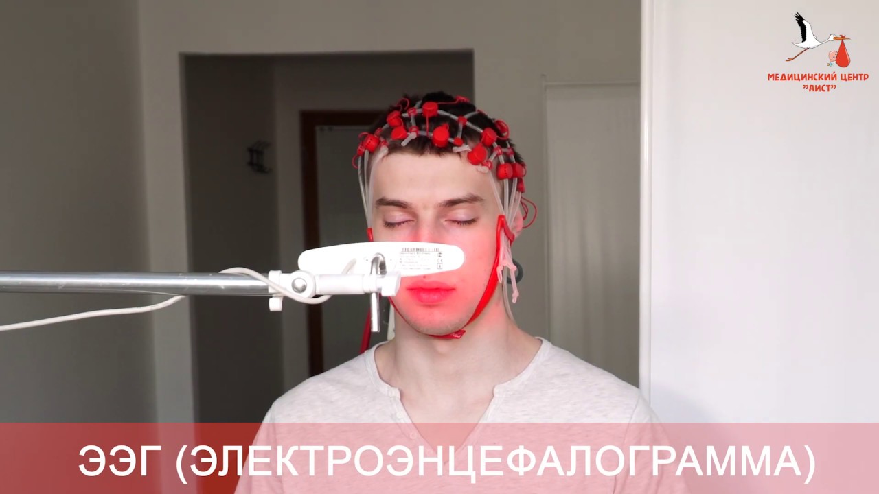 ⁣ЭЭГ головного мозга: что показывает? Electroencephalography (EEG)